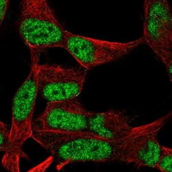 OCT1 Antibody, Novus Biologicals 0.1mL; Unlabeled:Antibodies, Polyclonal